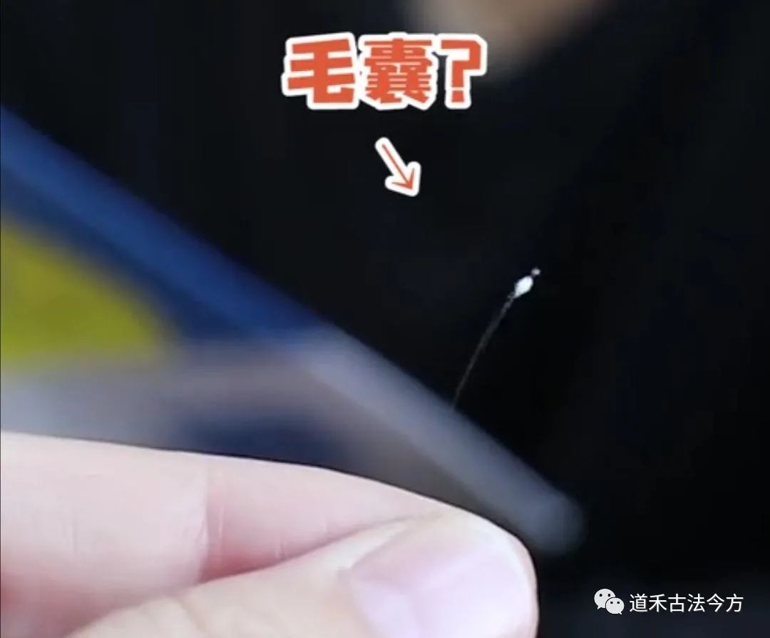 發(fā)根的小白點是毛囊掉了嗎？這些頭發(fā)信號要警惕！