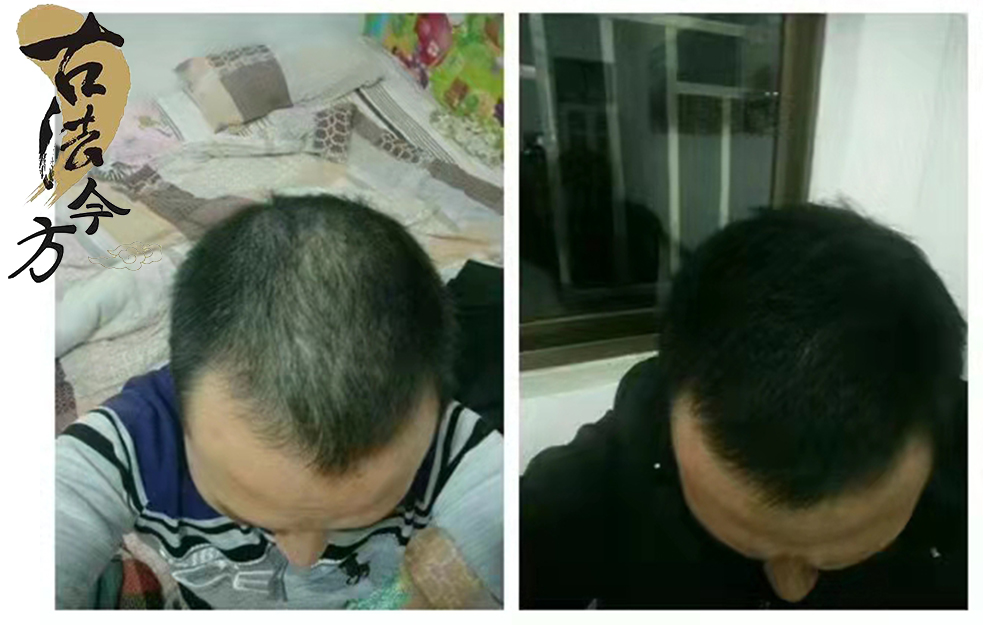 道禾古法今方生發(fā)