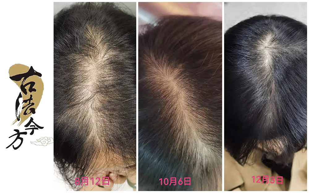 道禾古法今方生發(fā)秘方